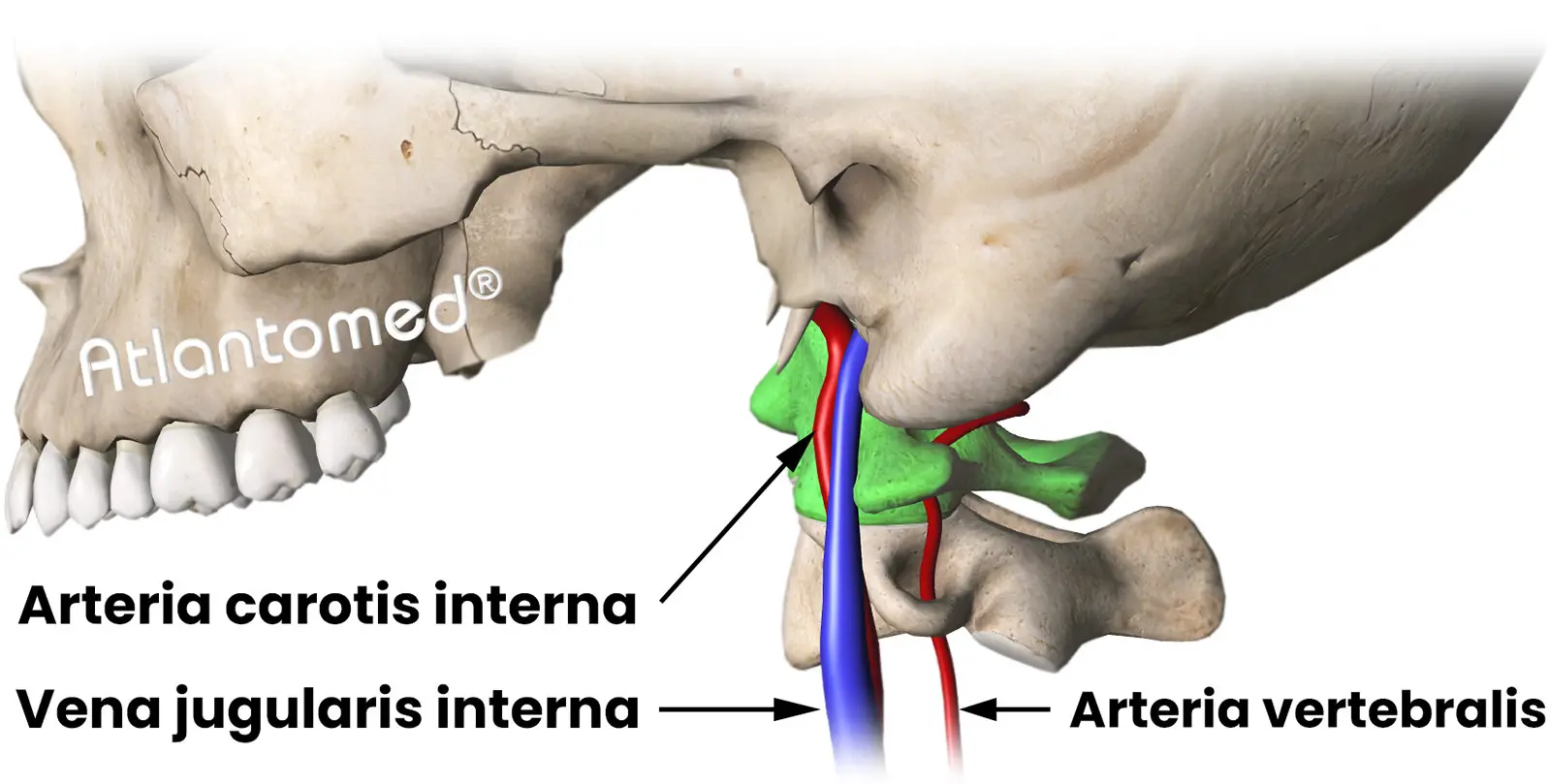 Arteria carotis interna, Vena jugularis interna und Arteria vertebralis in anatomischem Bezug zum Atlas und Schädel
